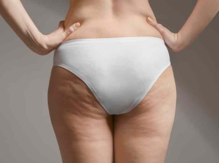 Cellulite ecco cosa devi fare ogni giorno -Food.it (Fonte foto Canva)